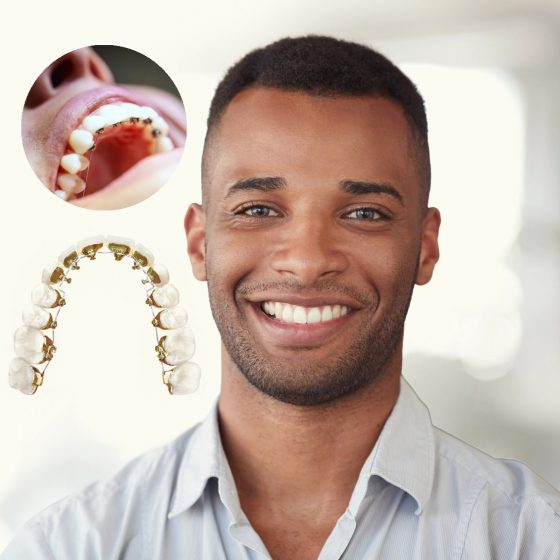 How Braces Help Fix Complex Alignment Issues